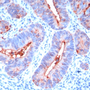 Carcinoembryonic Antigen (CEA) / CD66; Clone C66/195 (Concentrate)